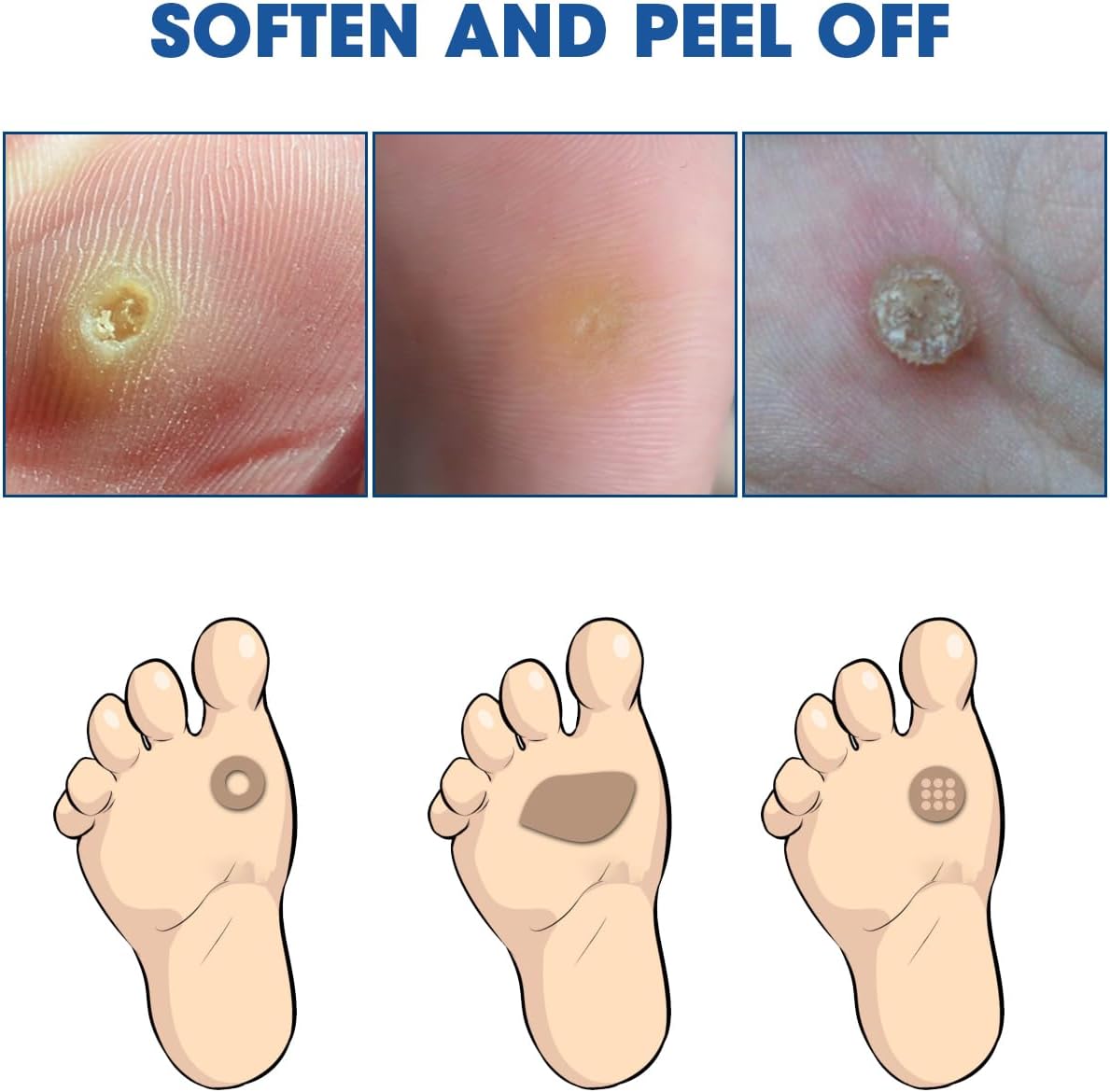 Liquid Corn Remover, Corn Removers for Toes, Fast Acting, Safe Removes Corns Fast Extra Strength for Kids and Adults, 15ml Liquid with 15PCS Cushions 10PCS Swabs (15ML*1)